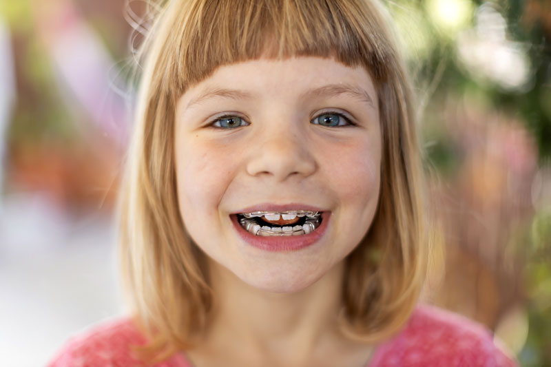 smiling girl wearing a retainer