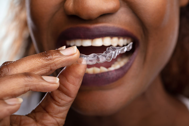 closeup of a woman holding Invisalign near her mouth