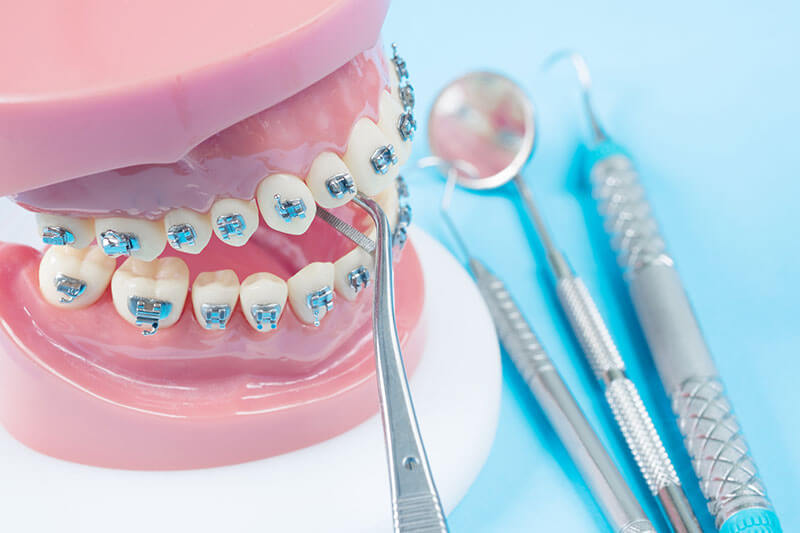 How long does orthodontic treatment take?